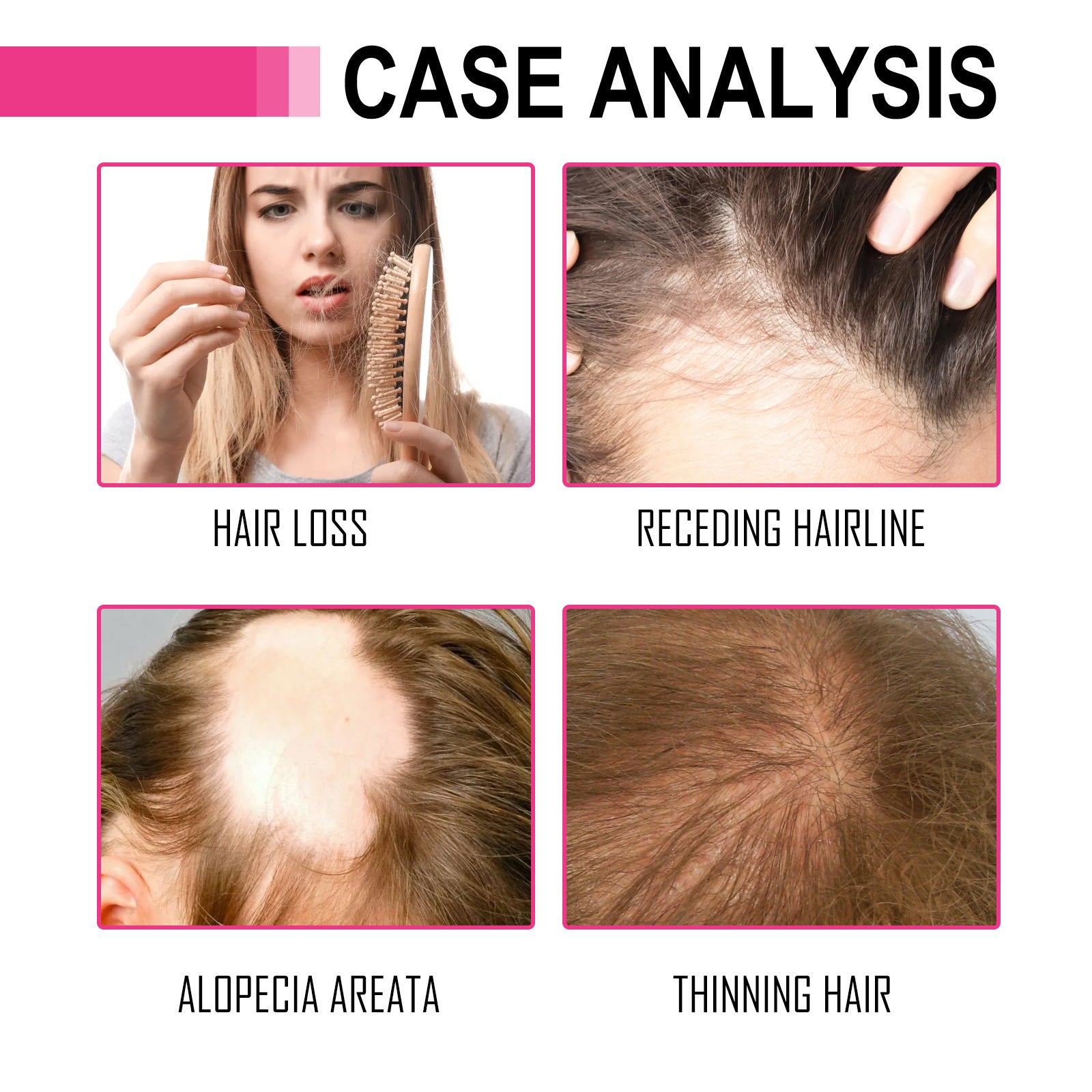 Huile essentielle de soin capillaire hydratante et réparatrice sèche et frizz